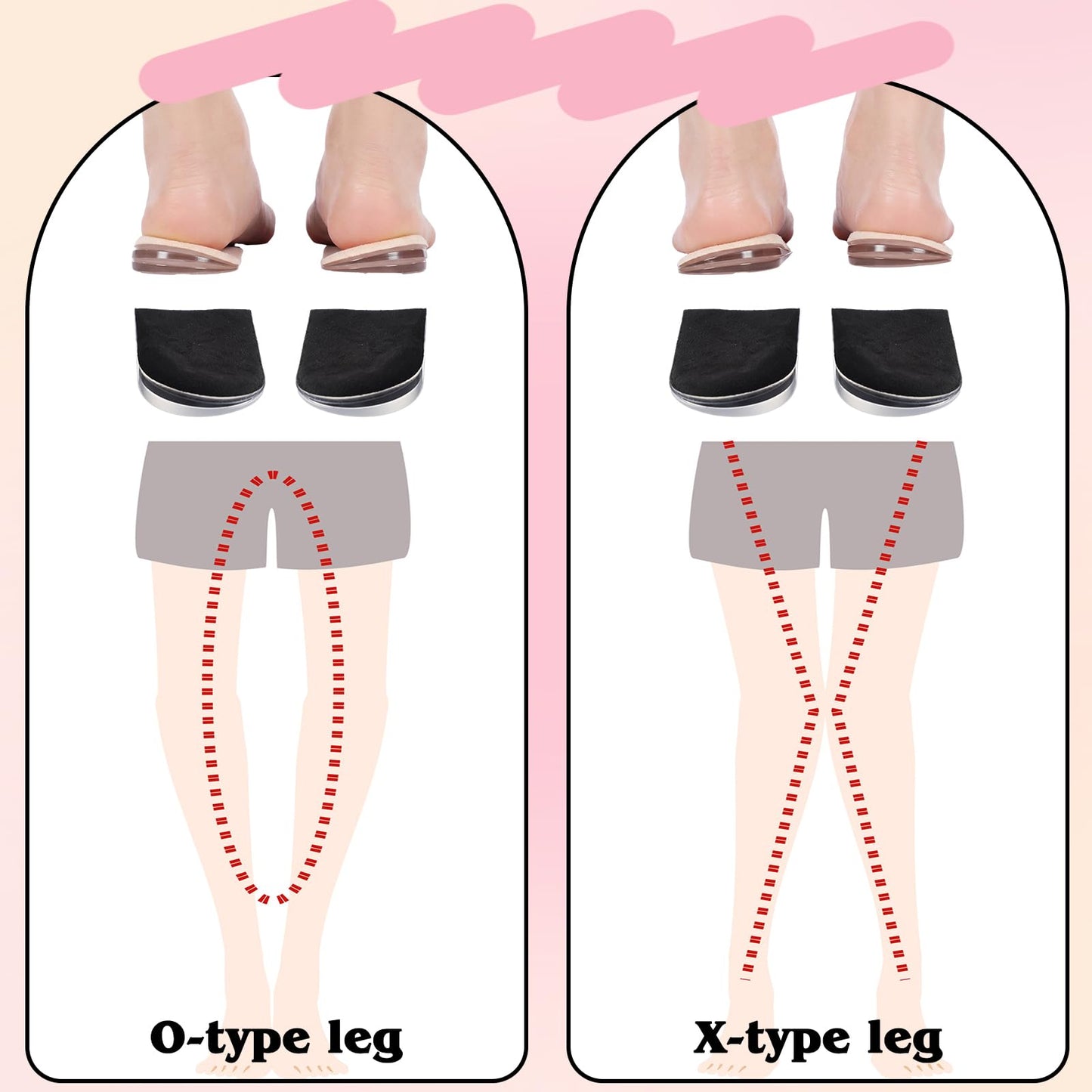 Cuffbow 4 Pairs 3 Layers Medial Lateral Heel Wedge Insoles Corrective Adhesive Shoe Inserts Wedge Inserts Adjustable Supination Overpronation Insoles for Foot Knock Knee Pain Bow Legs Osteoarthritis