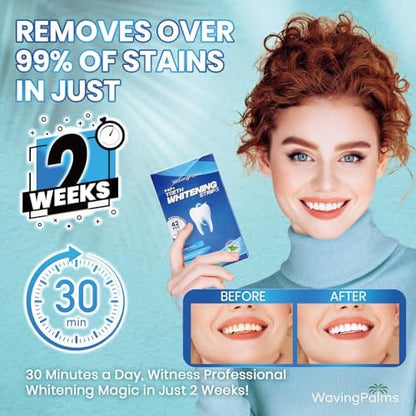 Sensitive Teeth Whitening Strips Kit: Professional Dental Whitening Set - Hydrogen Peroxide-Free Treatments for Whiter Teeth - Effective & Gentle Teeth Whitener (42 Count (Pack of 1), Mint)