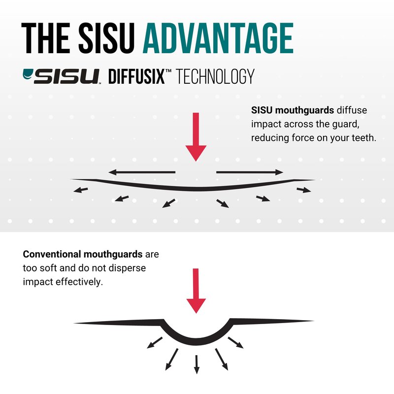 SISU Aero Small Mouthguard, Lucky Lavender - 30% Stronger Protection for Lacrosse, Football, Hockey, Roller Derby, Team Sports - Remoldable Up to 20 Times - Ultra Slim - Non Toxic