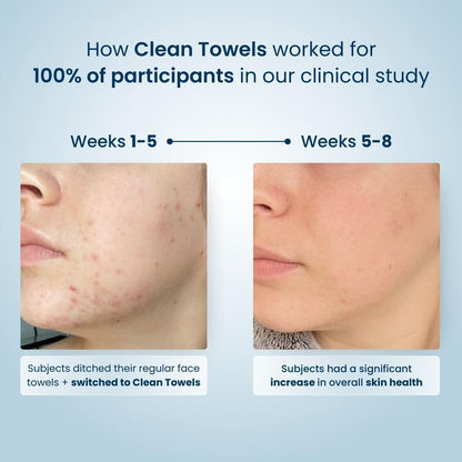 Clean Skin Club Clean Towels | Worlds 1ST Biodegradable Face Towel | Disposable Makeup Removing Wipes | Dermatology Tested & Approved | Vegan & Cruelty Free | Super Soft For Sensitive Skin | Dry Towelettes (Pack of 1 (25CT))