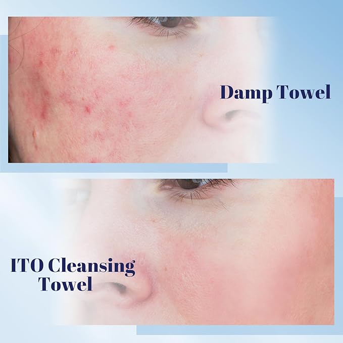 ITO Disposable Face Towel, Ultra-Soft 1-Second Quick-Dry Face Towels, Gentle
