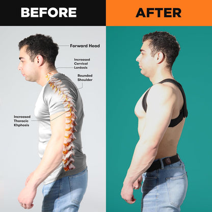 Premium Upper Back Brace for Men & Upper Back Brace for Women, Adjustable Posture Corrector, Upgraded Version, Back Brace for Alignment (L-XXL)