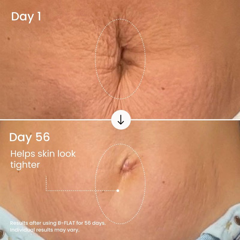 MAËLYS B-FLAT Belly Firming Cream for Women - Skin Tightening & Moisturizing Treatment with Shea Butter & Bentonite Clay - Smooths Look of Stretch Marks - Postpartum Body Care (3.4 Fl Oz)
