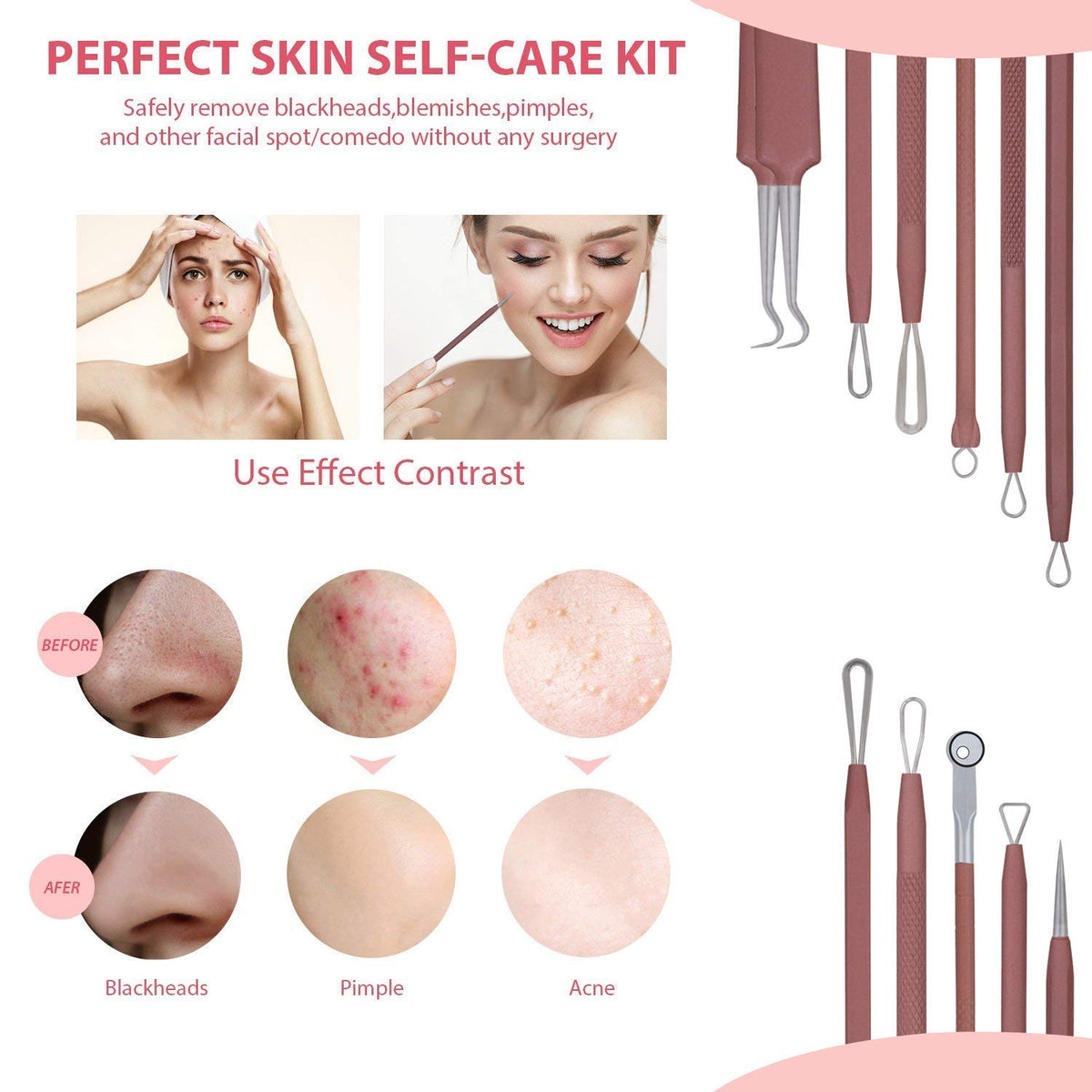 JPNK Blackhead Remover Comedone Extractor Acne Removal Kit..