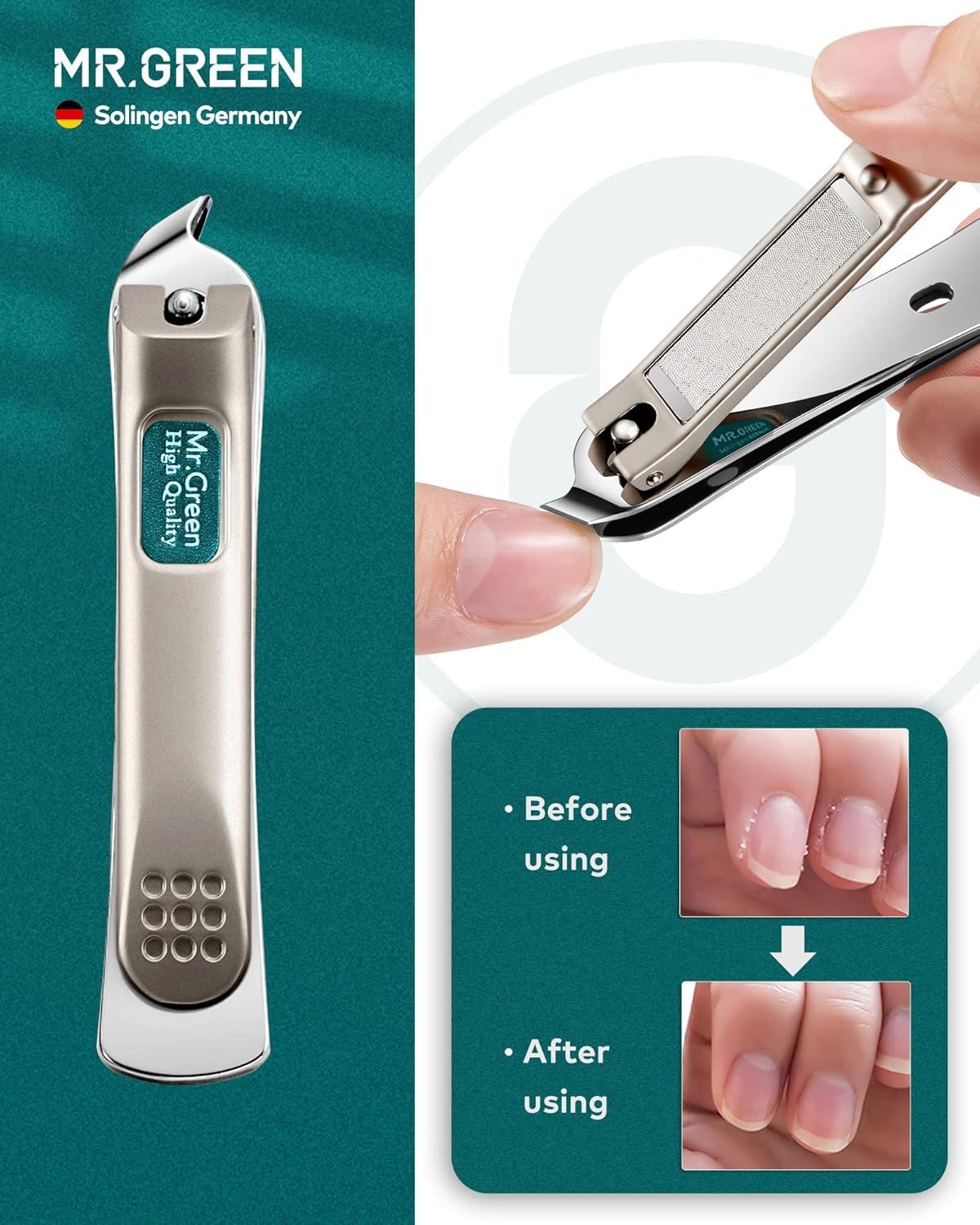 MR.GREEN 12-in-1 Manicure & Pedicure Set – Professional German Stainless Steel Nail Clippers,Cuticle Tools & Nail Care Kit, Travel Grooming Kit for Men & Women with Leather Case (Caramel Brown))