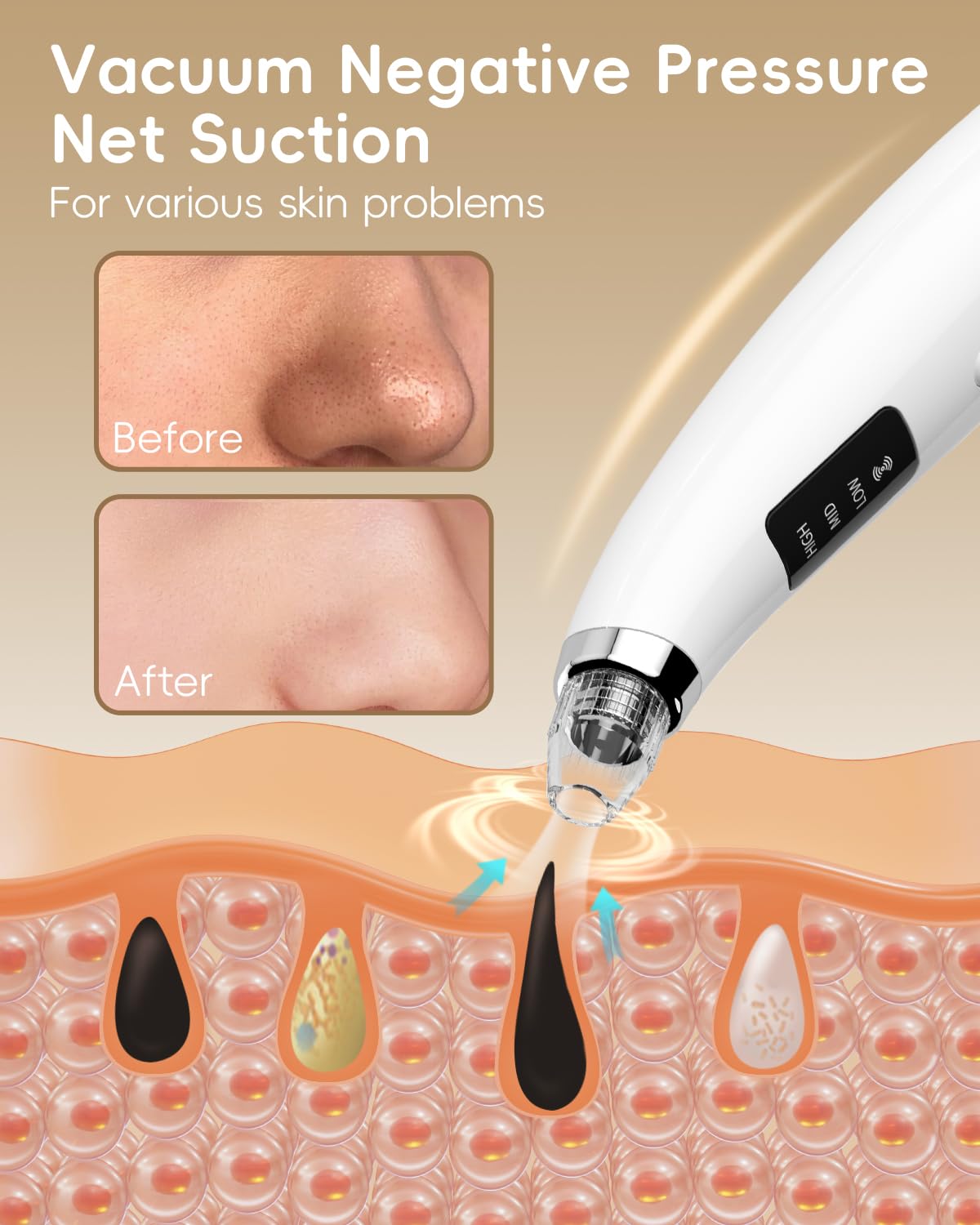 Facial Pore Blackhead Remover Vacuum - Fore Cleaner and Blackhead Extractor with 3 Adjustable Suction Levels - 5 Probes - Pore Vacuum Kit for Women&Men (White)