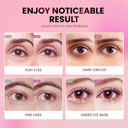 Under Eye Patches (24 Pairs) - New Tri-color Glitter Eye Gel Pads for Dark Circles Puffy Eyes,Under eye Bags,Wrinkles|Natural Collagen Under Eye Mask Patches, Gel Under Eye Patches