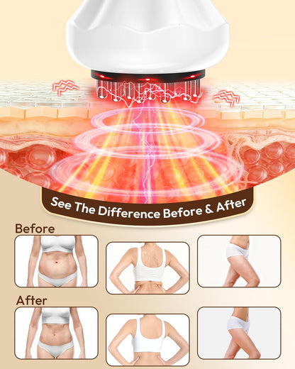 Glamesty Lymphatic Drainage Massager & Anti Cellulite Massage Tool, Body Sculpting Machine with Light, Soothing Pulse, Heat & Vibration, Heated Lymph Brush for Legs, Hip, Arms, Belly (White)