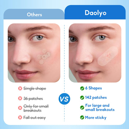 Pimple Patches for Face, 4 Size 300 Counts Acne Patches, Hydrocolloid Patches for Covering Zits and Blemishes, Spot Stickers with Salicylic Acid, Tea Tree Oil & Calendula Oil