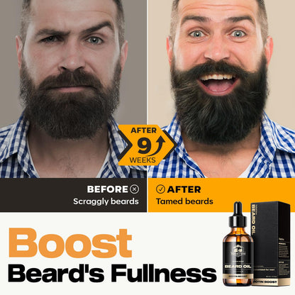 Waking Forest Beard Growth Oil - Biotin Sandalwood Oil with Vitamin E, Rosemary & Castor for Thicker, Softer, Stronger Beards (2oz)